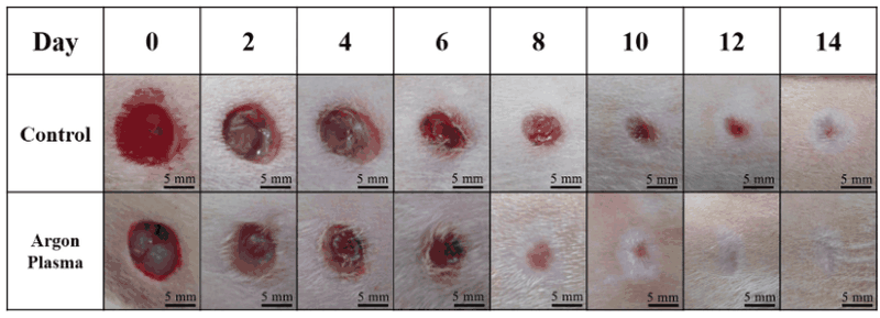 Wound healing